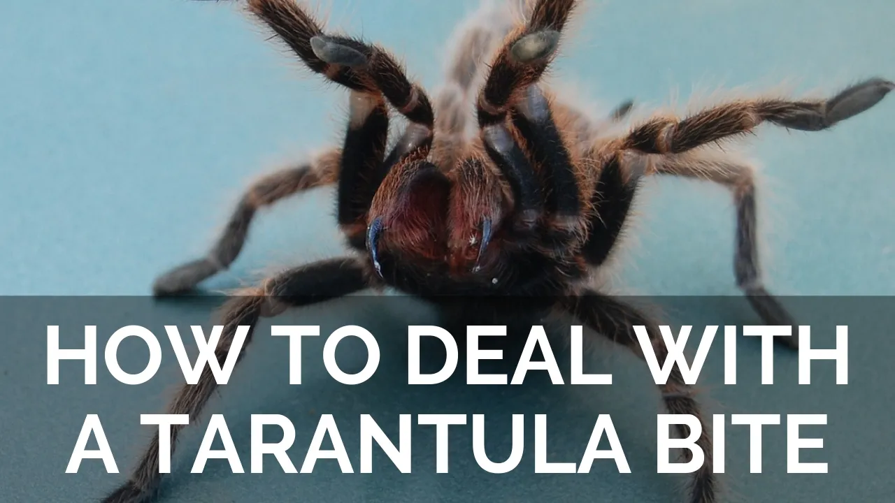17776 first aid tarantula bite